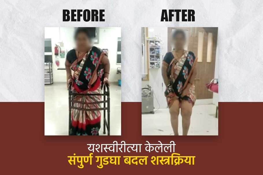 गुडघेदुखीपासून सुटका 