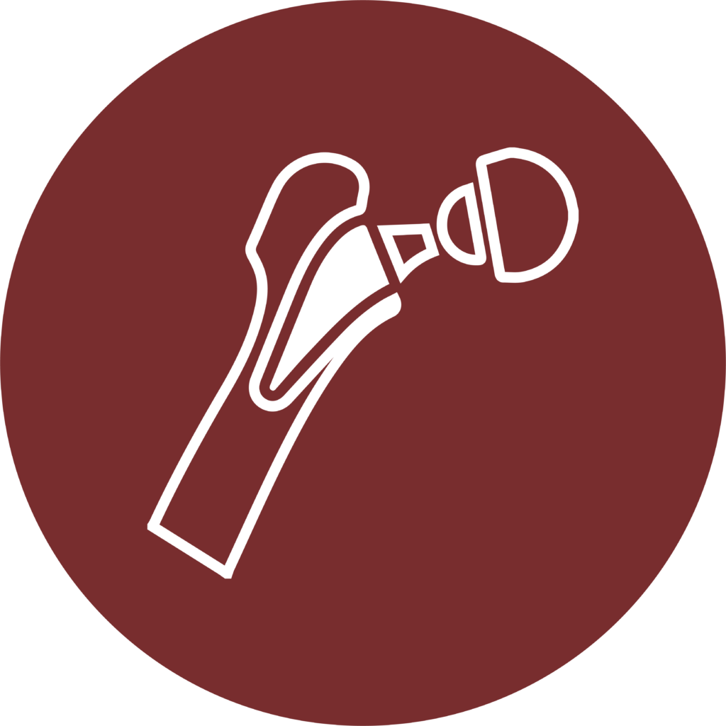 Hip replacement surgery