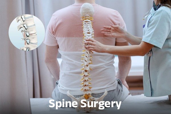 Doctor working on Spine Surgery