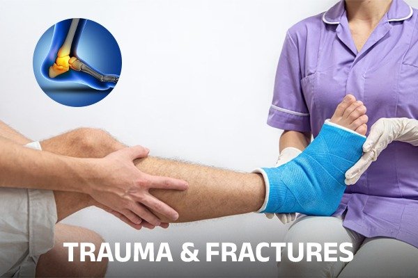 Surgeon treating Factured Patient