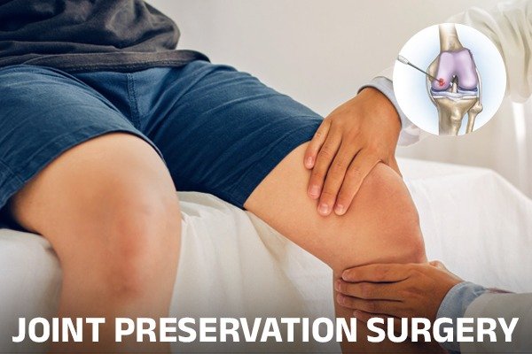 JOINT PRESERVATION SURGERY